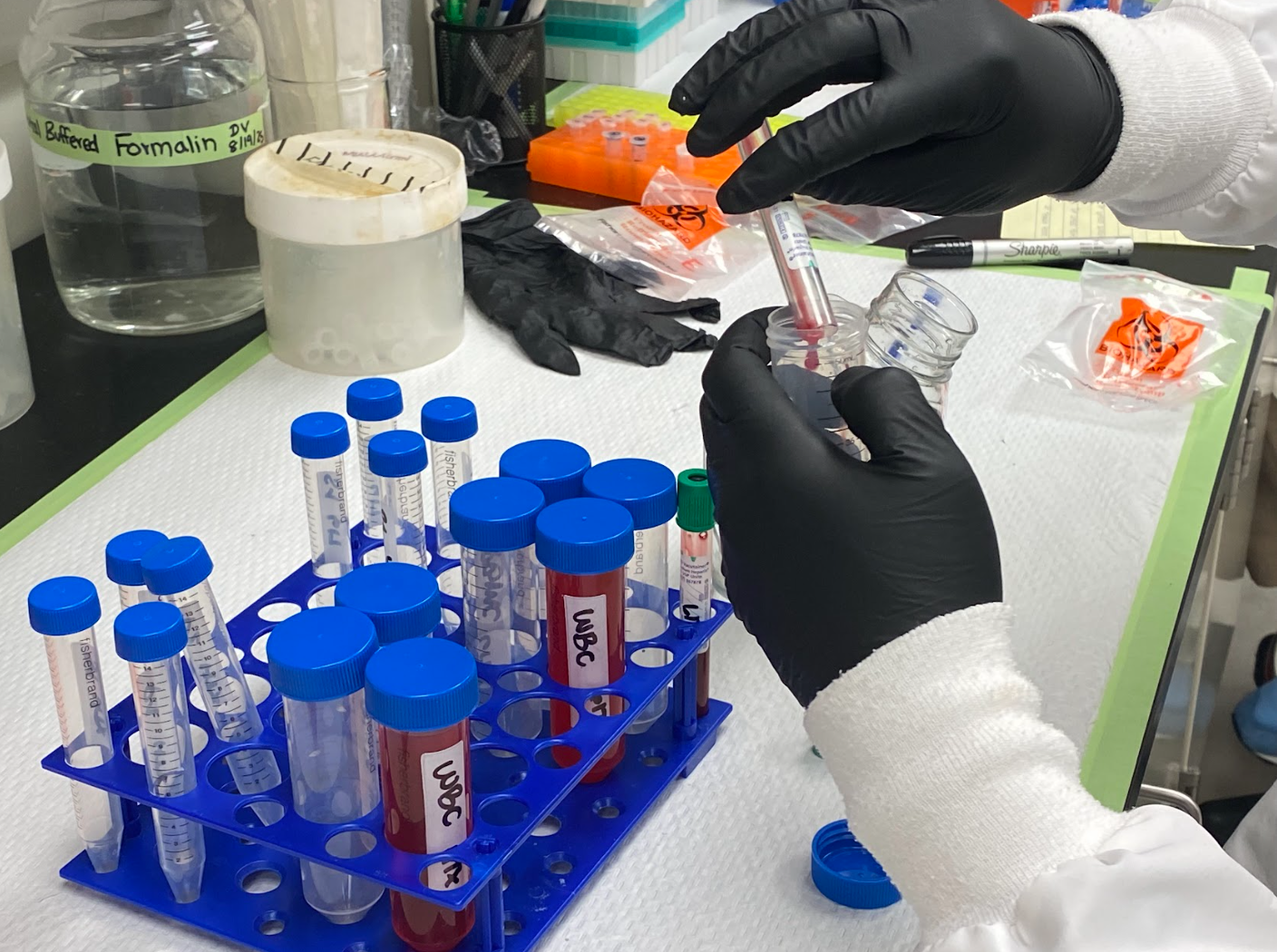 Cardiac Exo-Immunology